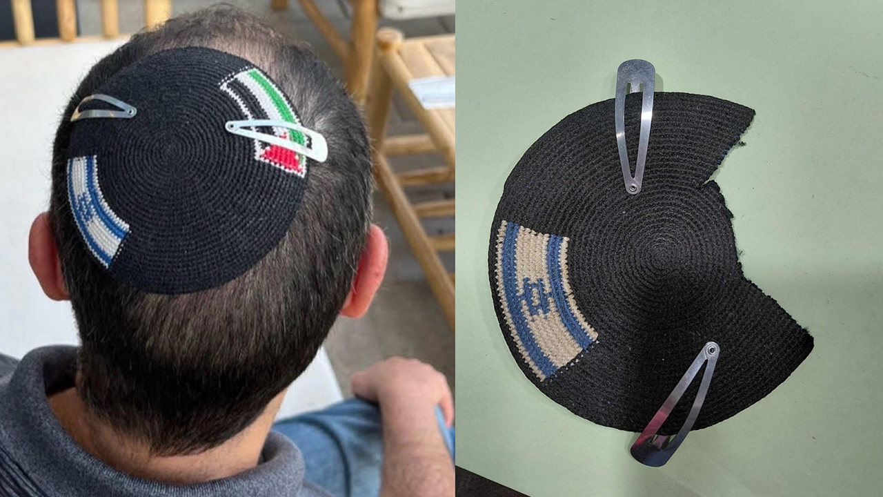 Alex Sinclair wore a kippah showing the Israeli and Palestinian flags for years, until he said a police officer took it from him and cut off the Palestinian flag in April 2026. (Courtesy Sinclair)